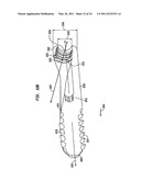 INTRAMEDULLARY FIXATION ASSEMBLY AND METHOD OF USE diagram and image