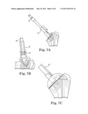 HUMERAL HEAD SHAPING DEVICE AND METHOD diagram and image