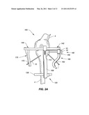 INSTRUMENTS FOR A VARIABLE ANGLE APPROACH TO A JOINT diagram and image