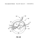 INSTRUMENTS FOR A VARIABLE ANGLE APPROACH TO A JOINT diagram and image