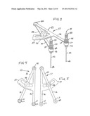 Extracapsular Surgical Procedure and Surgical Referencing Instrument Therefor diagram and image