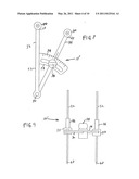 Extracapsular Surgical Procedure and Surgical Referencing Instrument Therefor diagram and image