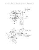 Extracapsular Surgical Procedure and Surgical Referencing Instrument Therefor diagram and image