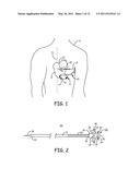 IMPLANTABLE MEDICAL DEVICE SYSTEM WITH FIXATION MEMBER diagram and image
