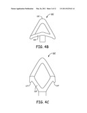 IMPLANTABLE MEDICAL DEVICE SYSTEM WITH FIXATION MEMBER diagram and image