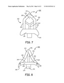 IMPLANTABLE MEDICAL DEVICE SYSTEM WITH FIXATION MEMBER diagram and image