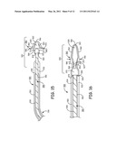 IMPLANTABLE MEDICAL DEVICE SYSTEM WITH FIXATION MEMBER diagram and image