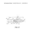 IMPLANTABLE MEDICAL DEVICE SYSTEM WITH FIXATION MEMBER diagram and image