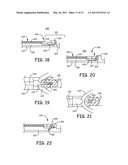 IMPLANTABLE MEDICAL DEVICE SYSTEM WITH FIXATION MEMBER diagram and image