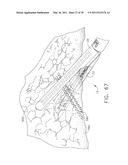 MOTORIZED SURGICAL CUTTING AND FASTENING INSTRUMENT diagram and image