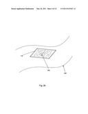 Light Activated Composite Tissue Adhesives diagram and image