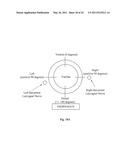 HYBRID METHOD FOR MODULATING UPPER AIRWAY FUNCTION IN A SUBJECT diagram and image