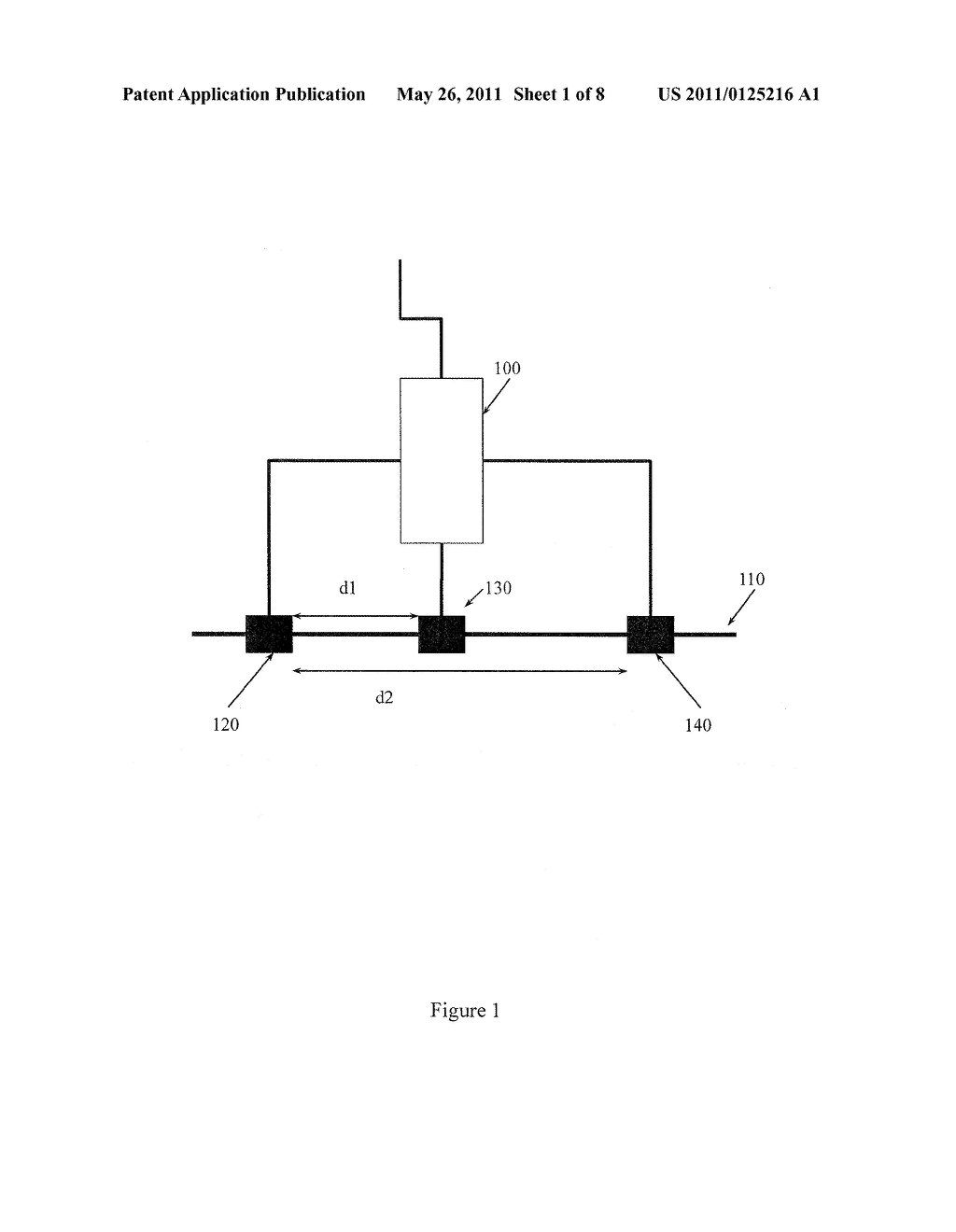 ADJUSTABLE NERVE ELECTRODE - diagram, schematic, and image 02