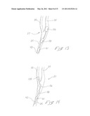 INDWELLING HEAT EXCHANGE CATHETER AND METHOD OF USING SAME diagram and image