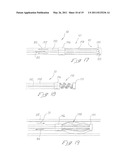 INDWELLING HEAT EXCHANGE CATHETER AND METHOD OF USING SAME diagram and image