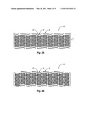 STENT HAVING AN EXPANDABLE WEB STRUCTURE diagram and image