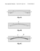 ARTIFICIAL CORNEA diagram and image