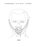 Adjustable Oral Airway Devices, And Adjustable Oral Airway Kits diagram and image