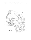 Adjustable Oral Airway Devices, And Adjustable Oral Airway Kits diagram and image