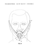Adjustable Oral Airway Devices, And Adjustable Oral Airway Kits diagram and image