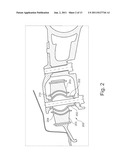DAMPING BUSHING FOR TORSION-BEAM REAR AXLE OF A MOTOR VEHICLE diagram and image