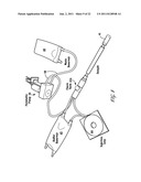 Portable and Cartridge-Based Surface Plasmon Resonance Sensing Systems diagram and image