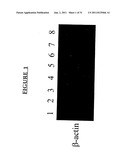 METHODS OF TREATING CANCER BY ADMINISTERING ANTIBODIES TO CD200 diagram and image