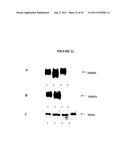 Membrane transporter NaPi2b (SCL34A1) epitope for antibody therapy,     antibodies directed thereto, and target for cancer therapy diagram and image