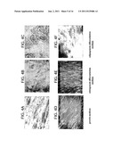 METHODS OF TREATING INFLAMMATORY COLON DISEASES diagram and image