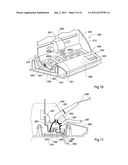 DENTAL RESTORATION CONDITIONING APPARATUS AND METHOD diagram and image