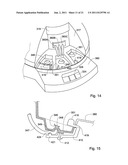 DENTAL RESTORATION CONDITIONING APPARATUS AND METHOD diagram and image