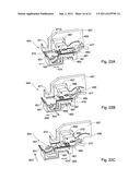 DENTAL RESTORATION CONDITIONING APPARATUS AND METHOD diagram and image
