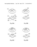 DENTAL RESTORATION CONDITIONING APPARATUS AND METHOD diagram and image