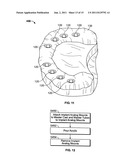METHOD OF CREATING AN ACCURATE BONE AND SOFT-TISSUE DIGITAL DENTAL MODEL diagram and image