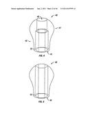 DENTAL IMPLANT SYSTEM AND ADDITIONAL METHODS OF ATTACHMENT diagram and image