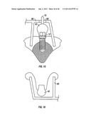 DENTAL IMPLANT SYSTEM AND ADDITIONAL METHODS OF ATTACHMENT diagram and image