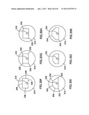 DENTAL IMPLANT SYSTEM AND ADDITIONAL METHODS OF ATTACHMENT diagram and image