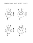 DENTAL IMPLANT SYSTEM AND ADDITIONAL METHODS OF ATTACHMENT diagram and image