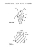 DENTAL IMPLANT SYSTEM AND ADDITIONAL METHODS OF ATTACHMENT diagram and image