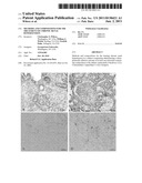 Methods and Compositions for the Treatment of Chronic Renal Hypertension diagram and image