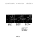 Magnetically Responsive Nanoparticle Therapeutic Constructs and Methods of     Making and Using diagram and image