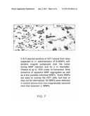Magnetically Responsive Nanoparticle Therapeutic Constructs and Methods of     Making and Using diagram and image