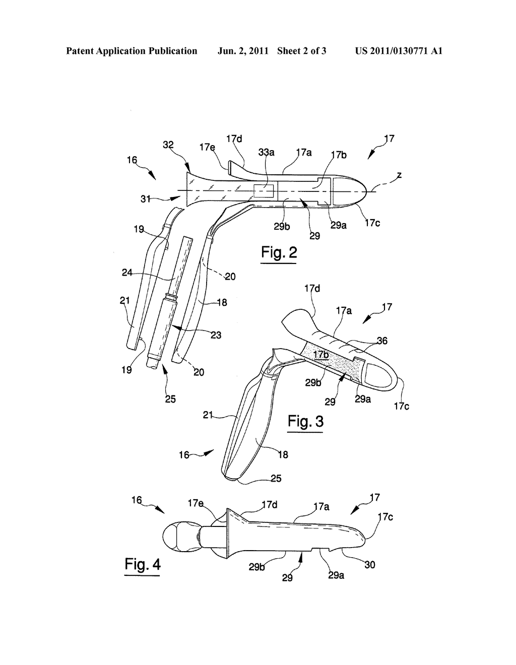 PROCESS AND A DEVICE FOR SURGICAL TREATMENT OF RECTAL AND HAEMORRHOIDAL     PROLAPSE - diagram, schematic, and image 03