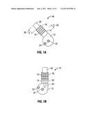 ULTRASONIC TISSUE DISSECTOR diagram and image