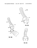 ULTRASONIC TISSUE DISSECTOR diagram and image