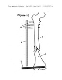 Method and Apparatus for Minimally Invasive Subcutaneous Treatment of Long     Bone Fractures diagram and image