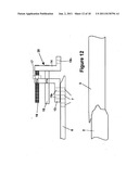 Method and Apparatus for Minimally Invasive Subcutaneous Treatment of Long     Bone Fractures diagram and image