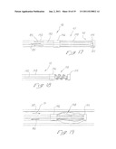 INDWELLING HEAT EXCHANGE CATHETER AND METHOD OF USING SAME diagram and image