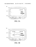 SYSTEMS AND METHODS FOR REPLACING SIGNAL ARTIFACTS IN A GLUCOSE SENSOR     DATA STREAM diagram and image