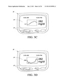 SYSTEMS AND METHODS FOR REPLACING SIGNAL ARTIFACTS IN A GLUCOSE SENSOR     DATA STREAM diagram and image